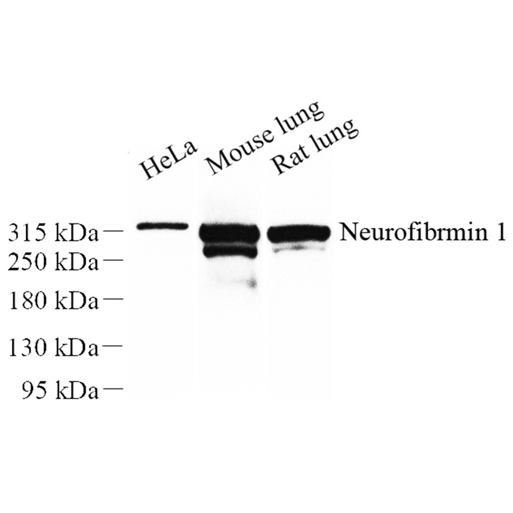 Anti -Neurofibromin Rabbit pAb