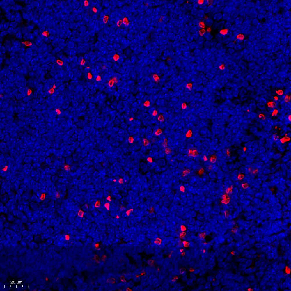 Anti -MCP5 Rabbit pAb