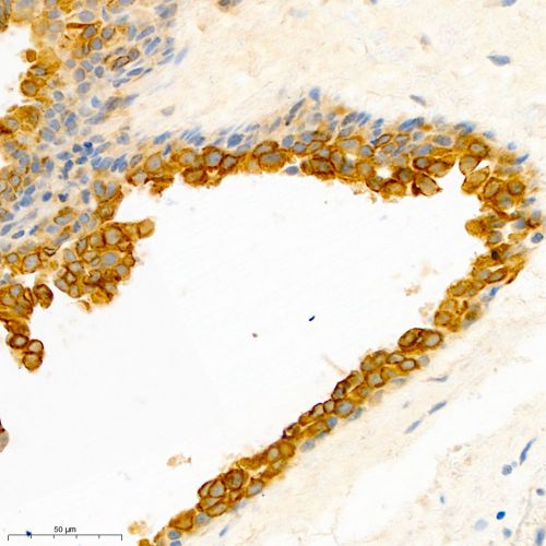 Anti -Cytokeratin 5 Rabbit pAb