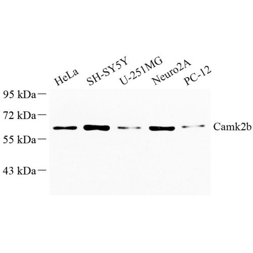 Anti -CAMK2B Rabbit pAb